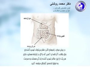 1دکتر محمد روشنی 2 300x225 - زخم اثنی عشر: علائم و درمان