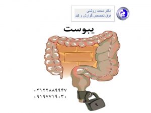 نکاتی در رابطه با یبوست محمد روشنی 300x225 - نکاتی در رابطه با یبوست