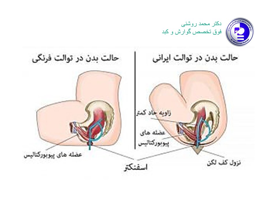 محمد روشنی 4 - توالت ایرانی یا فرنگی؟