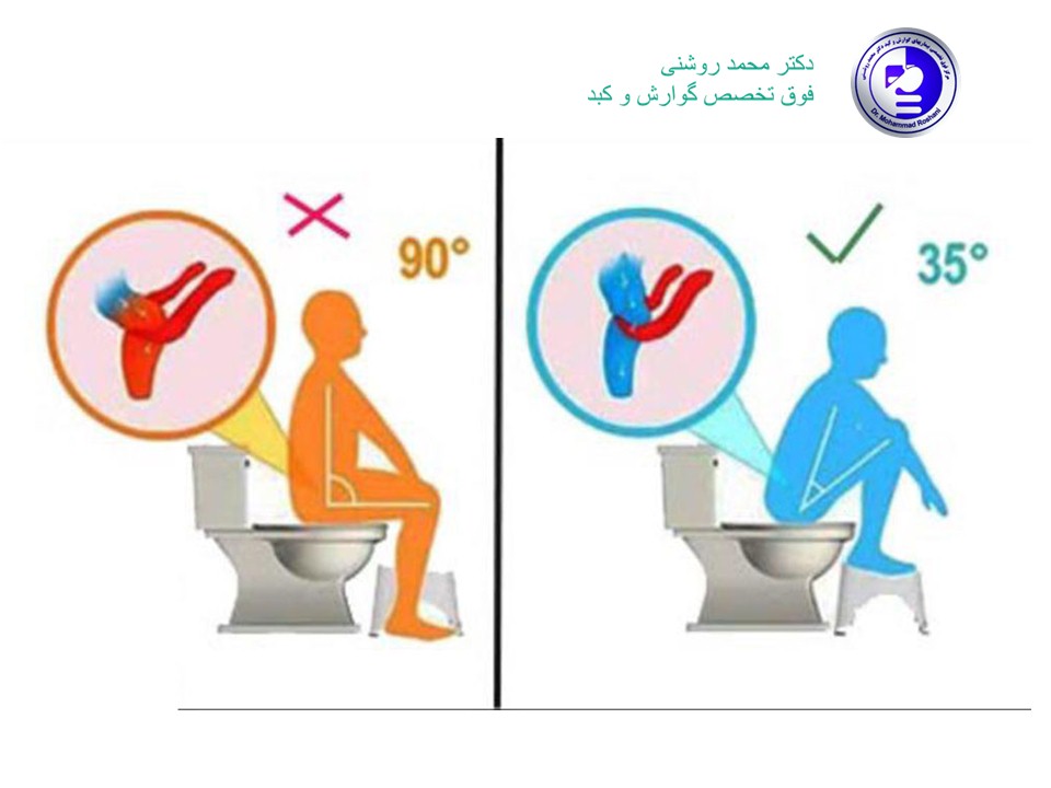 محمد روشنی 5 - توالت ایرانی یا فرنگی؟