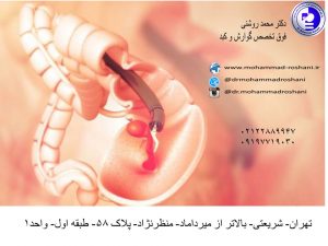 محمد روشنی 4 300x225 - سرطان روده بزرگ چیست؟