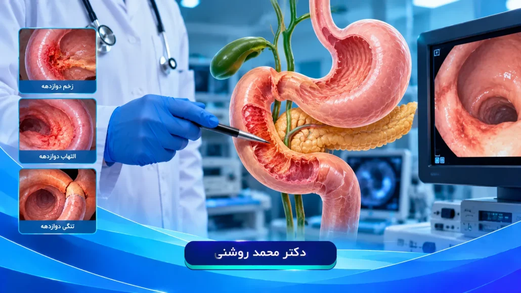 mohammad roshani.ir 1 5 1 1030x580 - بیماری های اثنی عشر